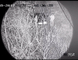 Υπέρυθρη κάμερα μακροχρόνιας σειράς νυχτερινής όρασης λέιζερ που ενσωματώνεται με στο φωτιστικό λέιζερ Nir